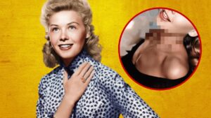 The Real Reason Behind Vera Ellen’s Enigmatic Neck Cover-Up in Hollywood