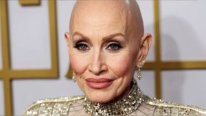 Dolly Parton Opens Up About Her Wigs: Embracing Transparency in the Public Eye