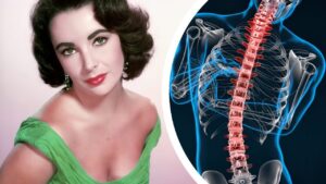 The Devastating Health Issues That Killed Elizabeth Taylor